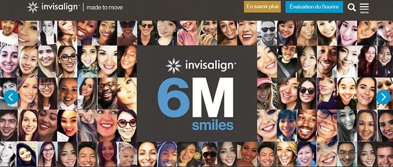 invisalign sourire parfait avis
